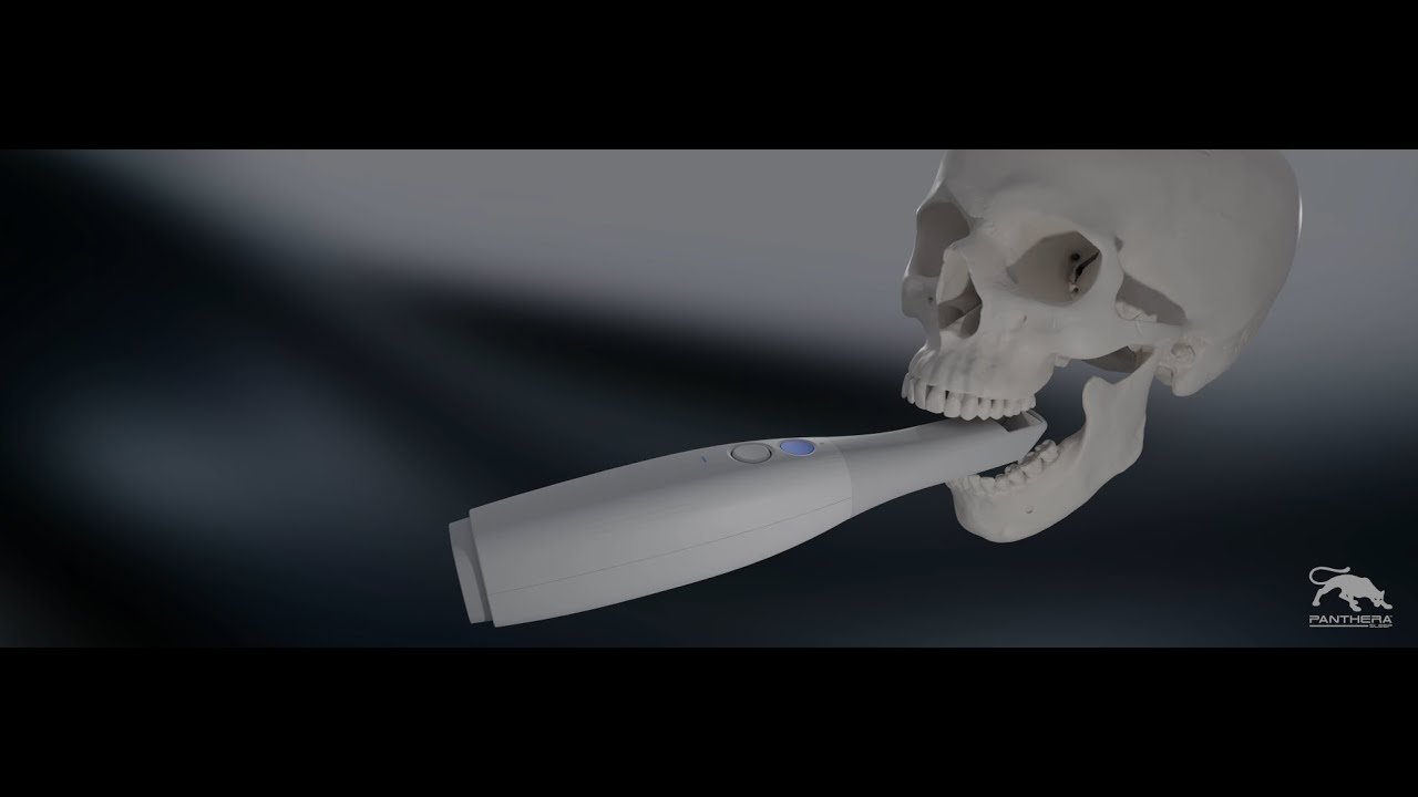 Empreinte dentaire optique : Comment effectuer une prise d'empreinte avec un scanner intraoral