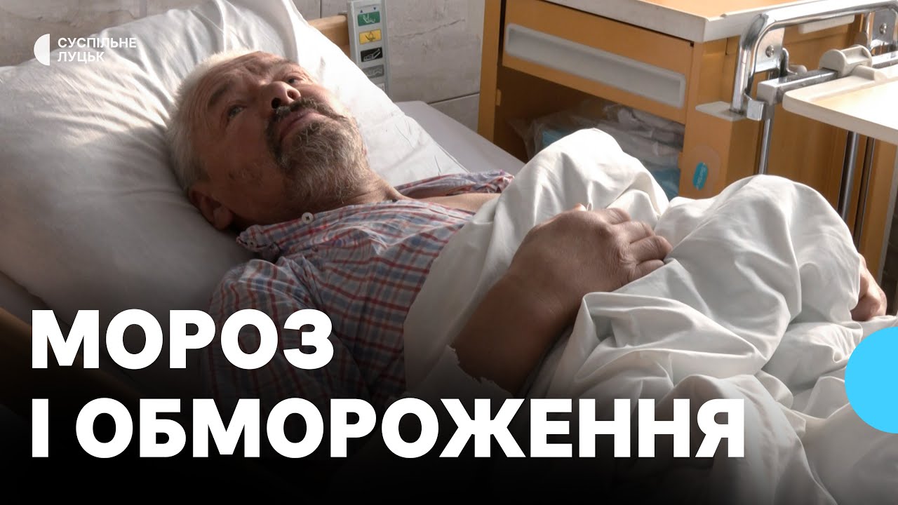 Ампутації через обмороження — історії двох пацієнтів