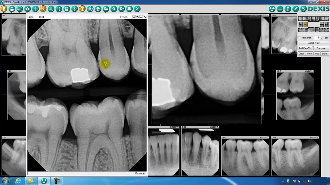 DEXIS&trade; Imaging Suite Toolbar Overview - Part Two