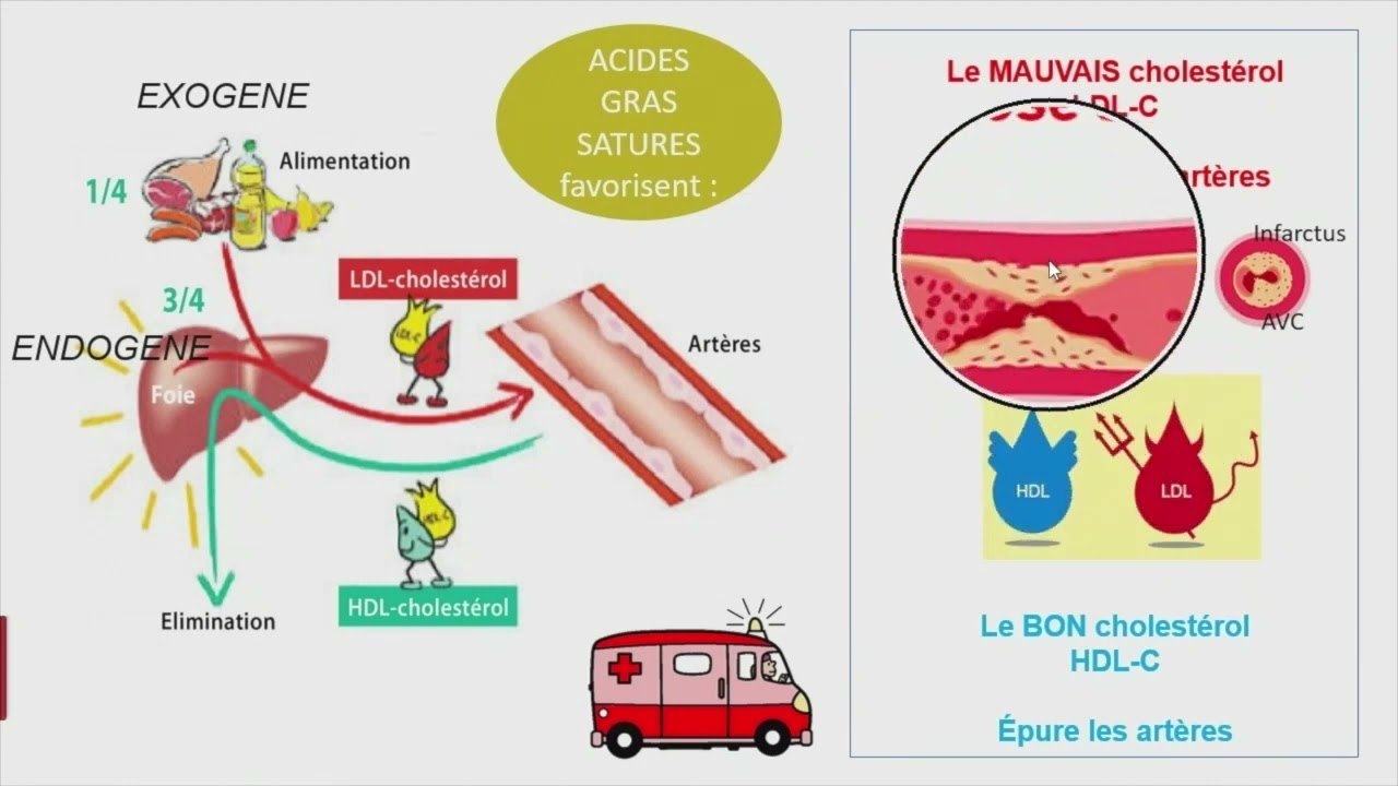 Fromages au lait cru, nutrition et santé