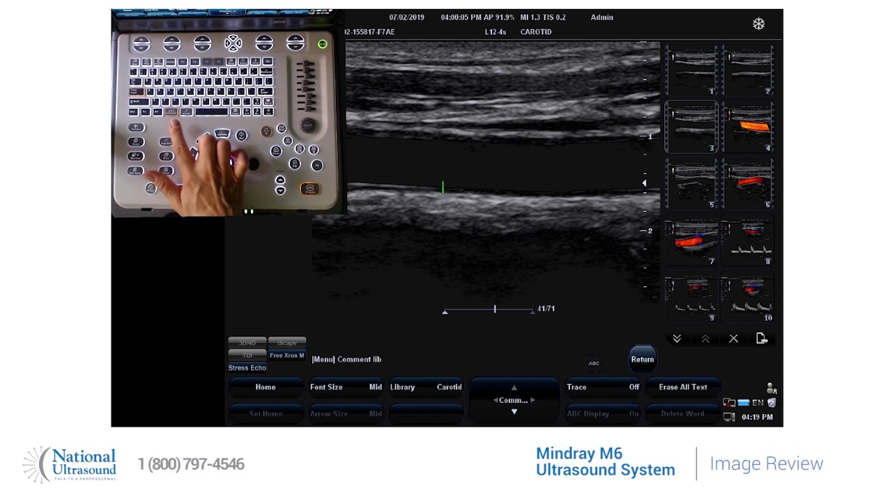 Mindray M6 Ultrasound Machine - How to view images