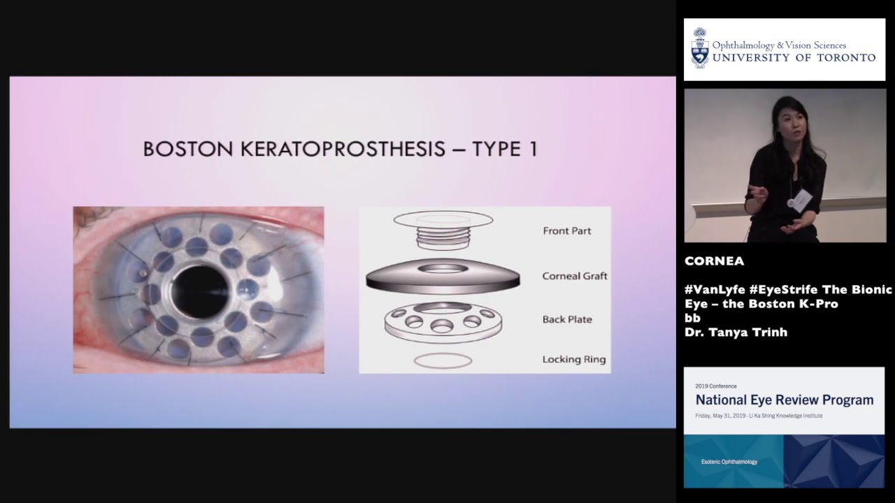 The bionic eye (Boston KPRO)