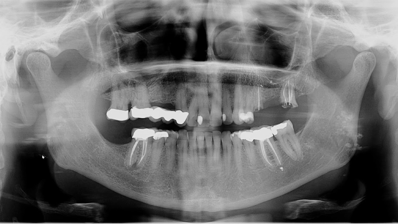 Quiz unknown radiopacities