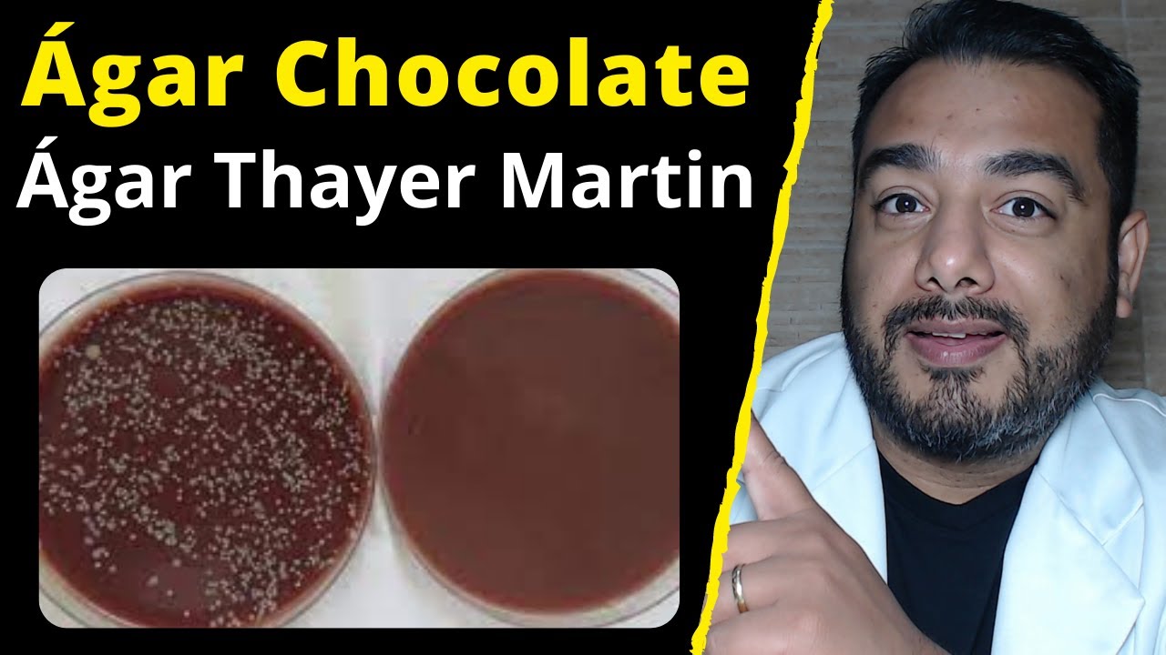 5) Ágar Chocolate e Thayer Martin | Meio de Cultura Para Neisseria | Curso de Microbiologia