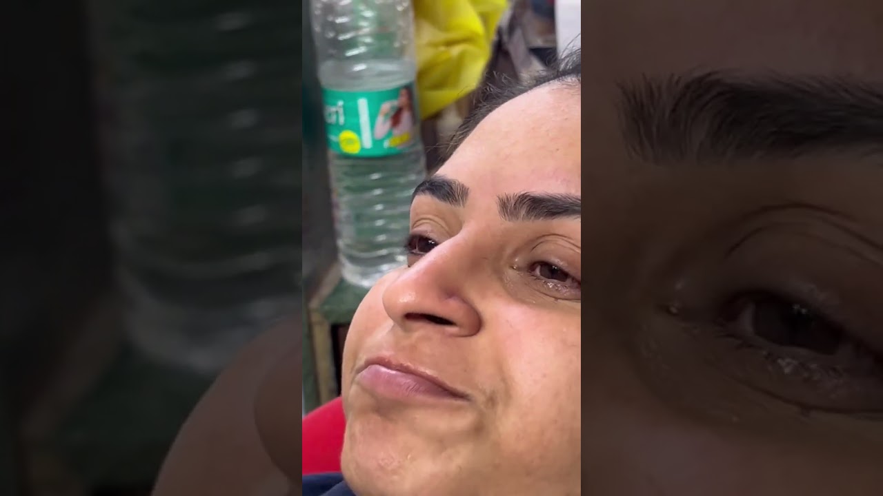 Explain eyebrow||
