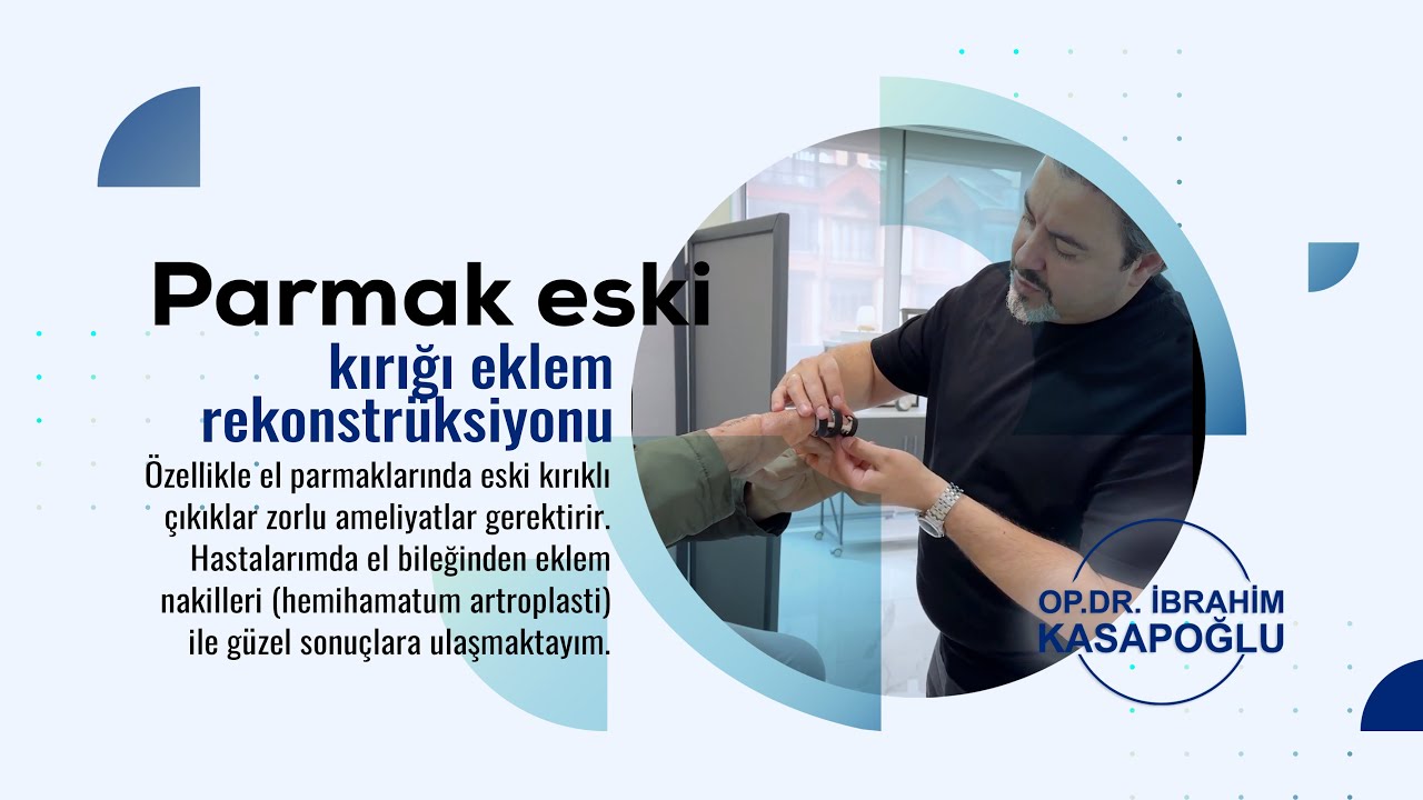 Parmak Eski Kırığı | Eklem Rekonstr&uuml;ksiyonu