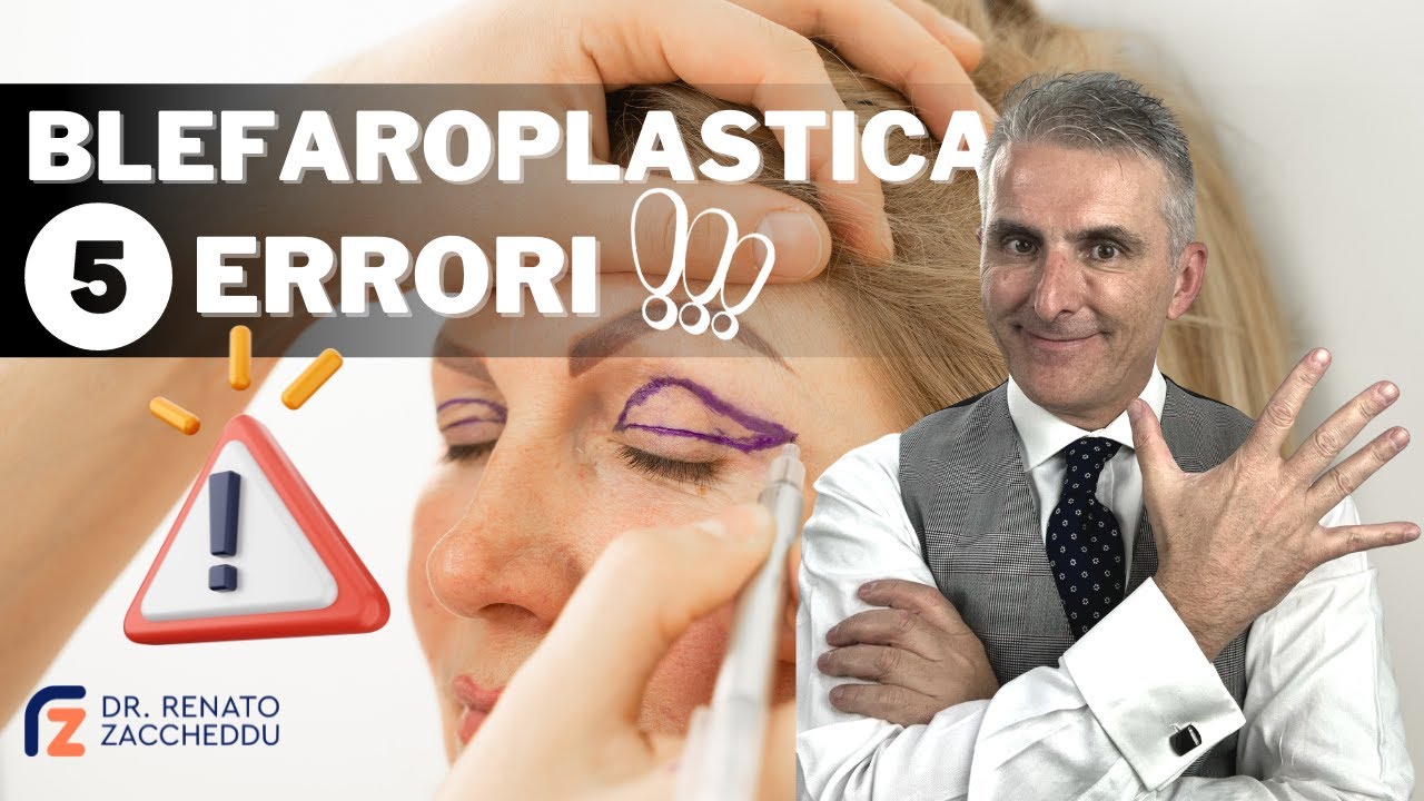 5 Errori da Evitare con la Blefaroplastica