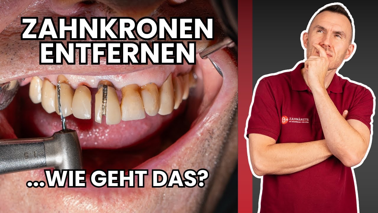Zahnkronen & Zahnbrücken entfernen (und wieder verwenden?): Kompletter Ablauf erklärt vom Zahnarzt!