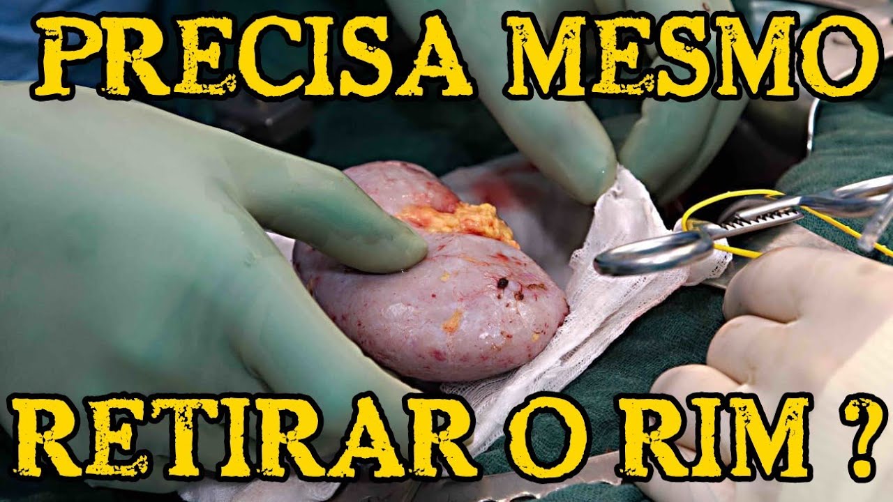 Quando o RIM Deve Ser RETIRADO nos Casos de INFEC&Ccedil;&Atilde;O ? | Cortes Renais Ep. 17