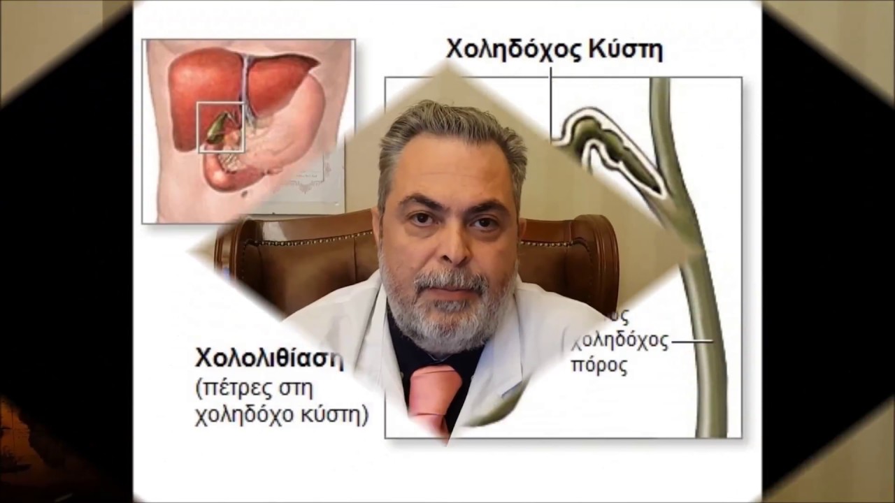 Πέτρα στη Χολή: Γιατί η Λαπαροσκοπική Χολοκυστεκτομή είναι η Οριστική Θεραπεία;
