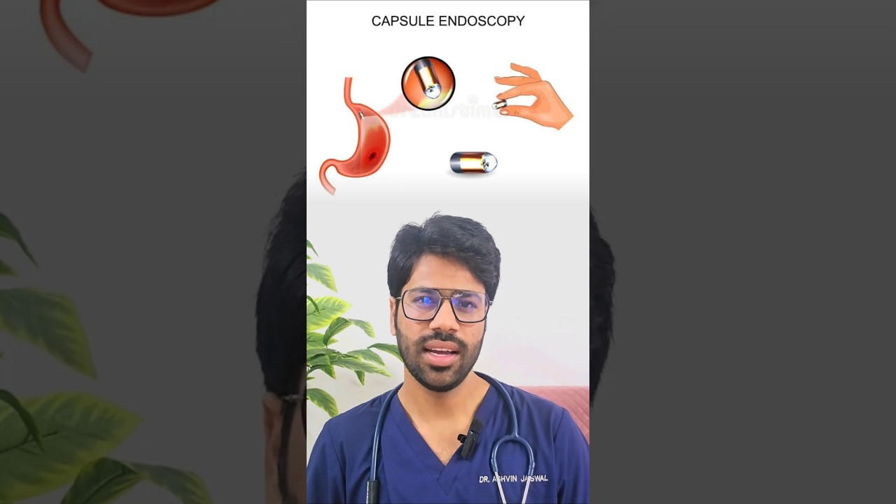 Capsule Endoscopy simple explanation #Dr Ashvin