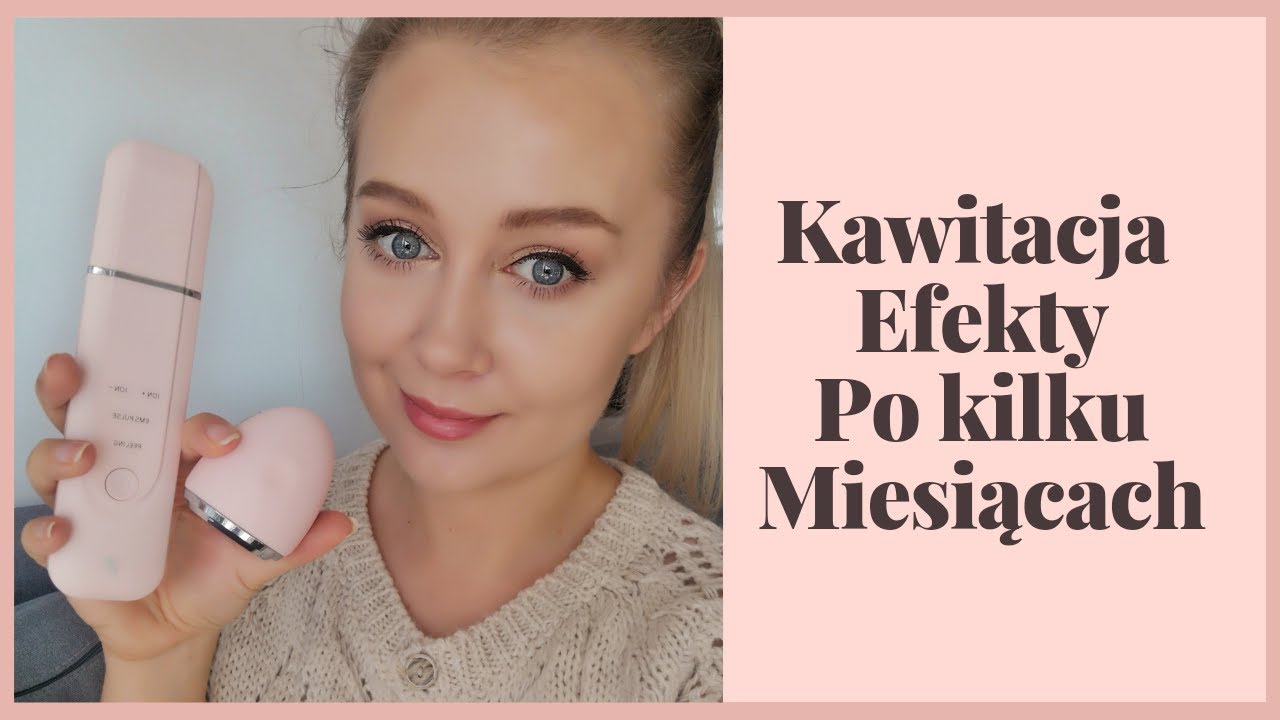 Domowa Kawitacja Efekty Po Kilku Miesiącach