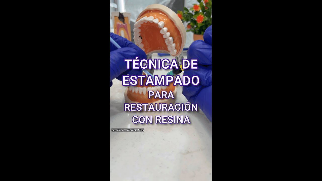 Tecnica de estampado dental