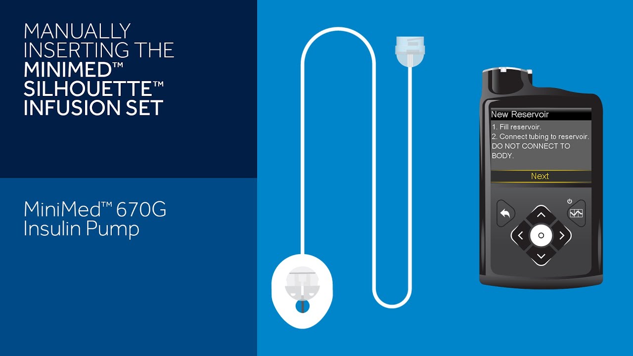 Manually Inserting the Silhouette Infusion Set with the MiniMed 670G Insulin Pump