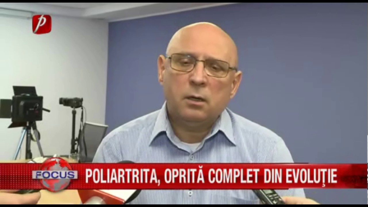 POLIARTRITA, OPRITĂ COMPLET DIN EVOLUŢIE