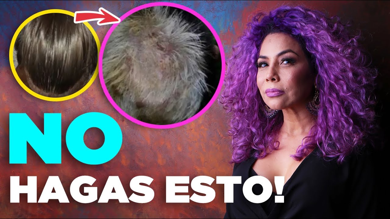 ¿Te Quemaste el Cuero Cabelludo? DEBES MIRAR ESTO #VerdadesIncomodas