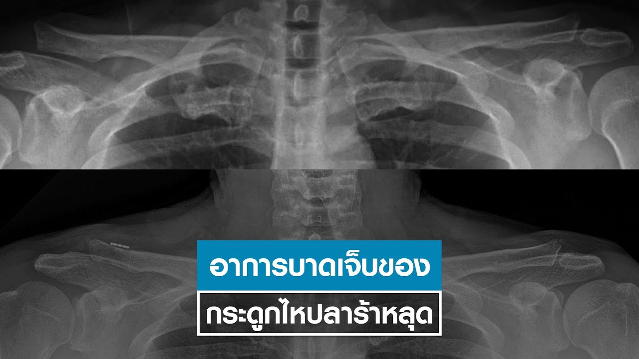 รายการ 5 นาทีกับแพทย์ธรรมศาสตร์ ตอน 