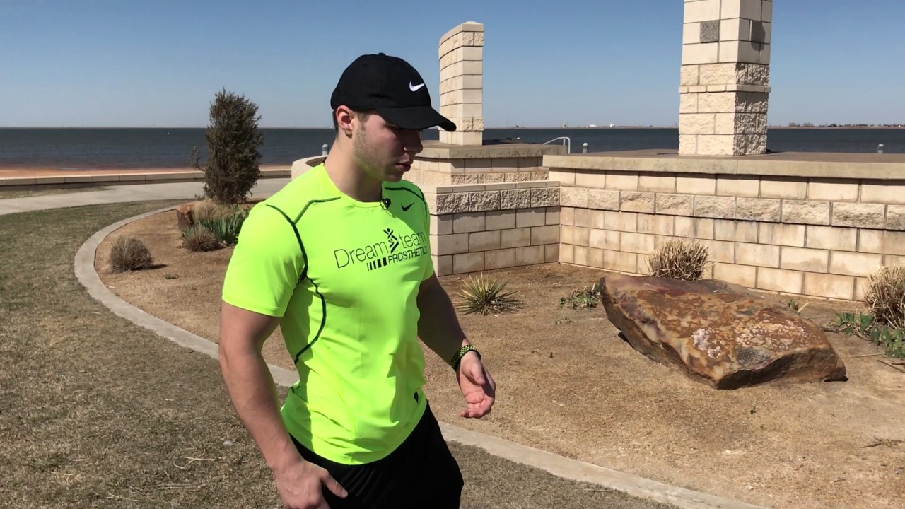 Bilateral Above Knee Full Time Prosthetic User