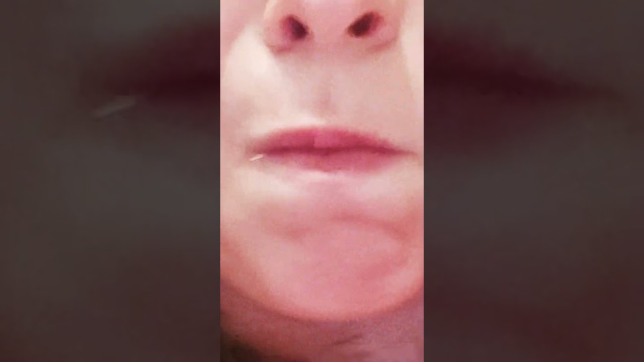 #Aparat
