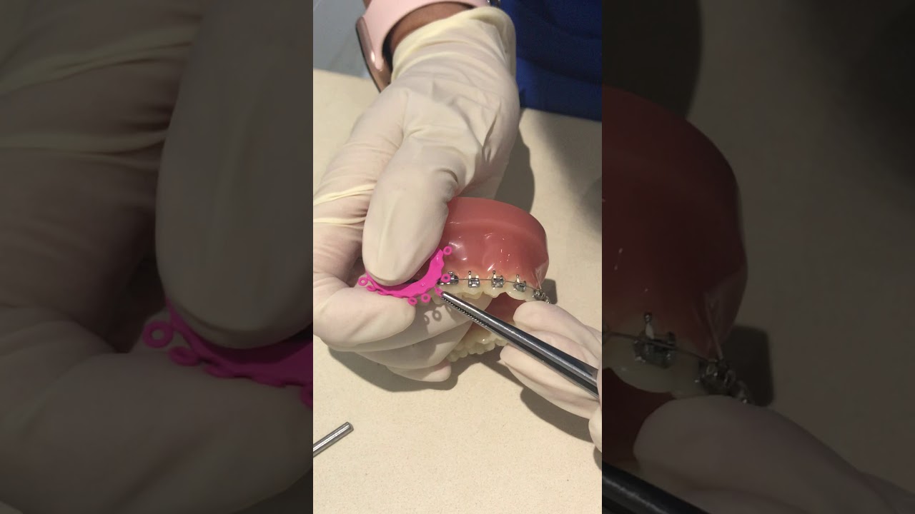 REPLACING O-RING