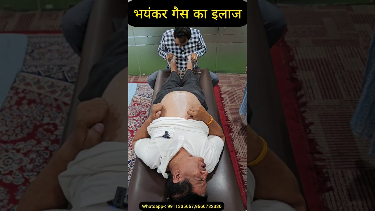 Treatment of severe gas. #gas #gastreatment #acidity #ytshorts #trend