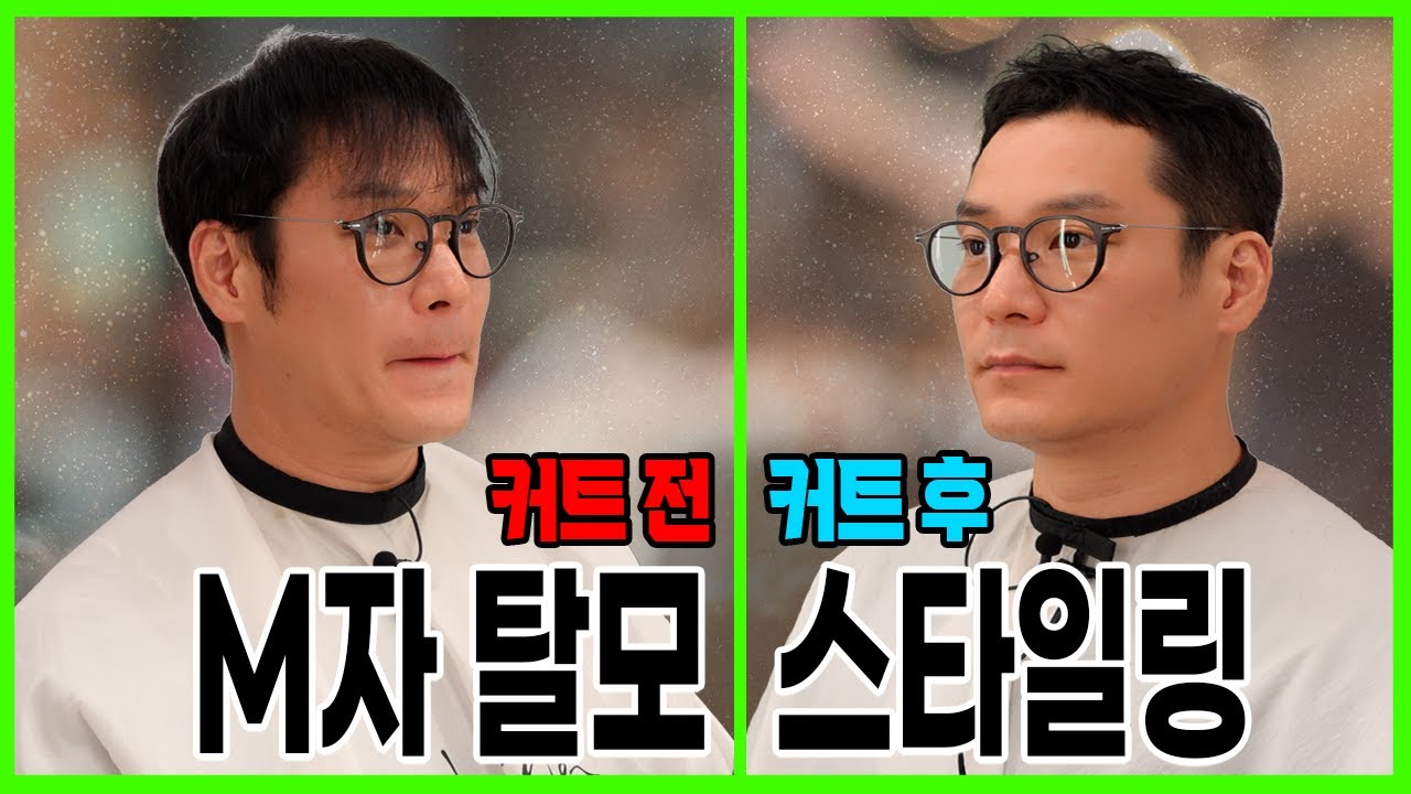 탈모 커버 스타일의 대변신🔥 M자 이마 스타일링 공개