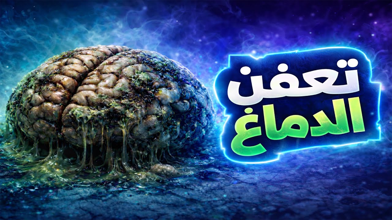 أجي نشرح ليك تعفن الدماغ بالدارجة! وكيفاش كيشكل خطر على حياتنا