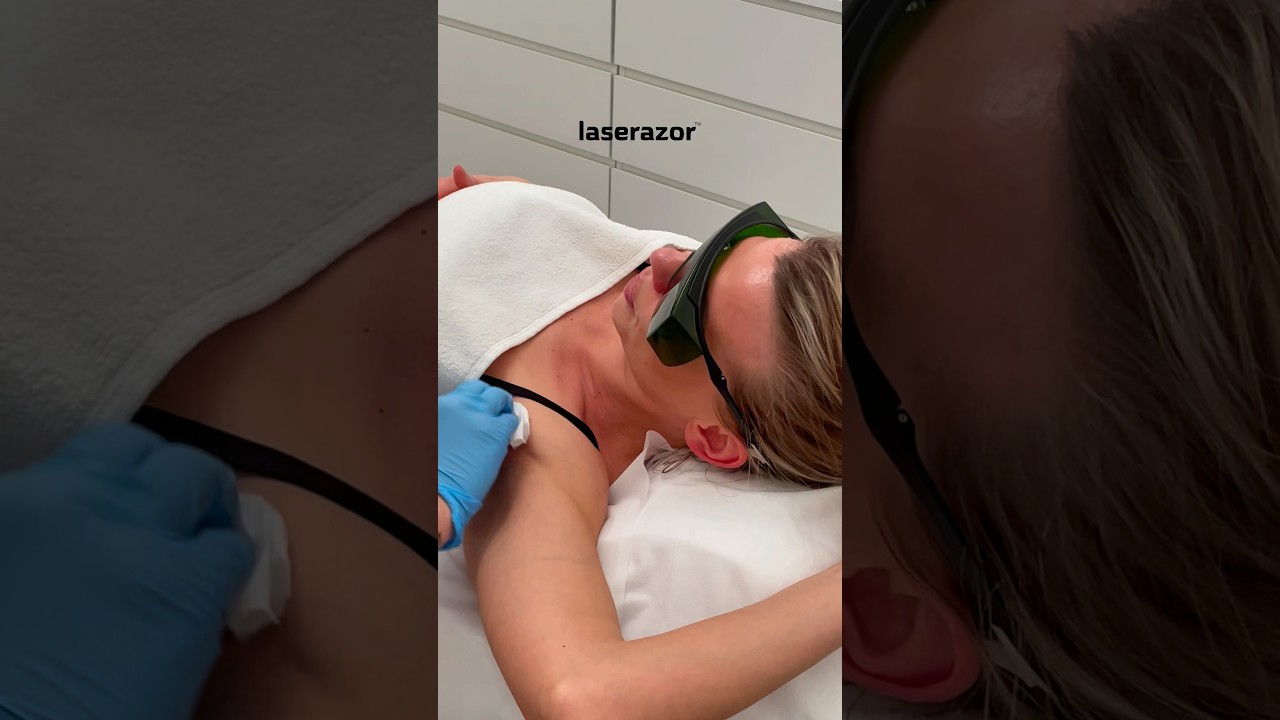 Achseln Laser Behandlung ist beliebt vor allem bei Sportlern.