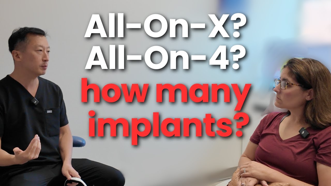 How Many Implants do you ACTUALLY need for All-on-4?