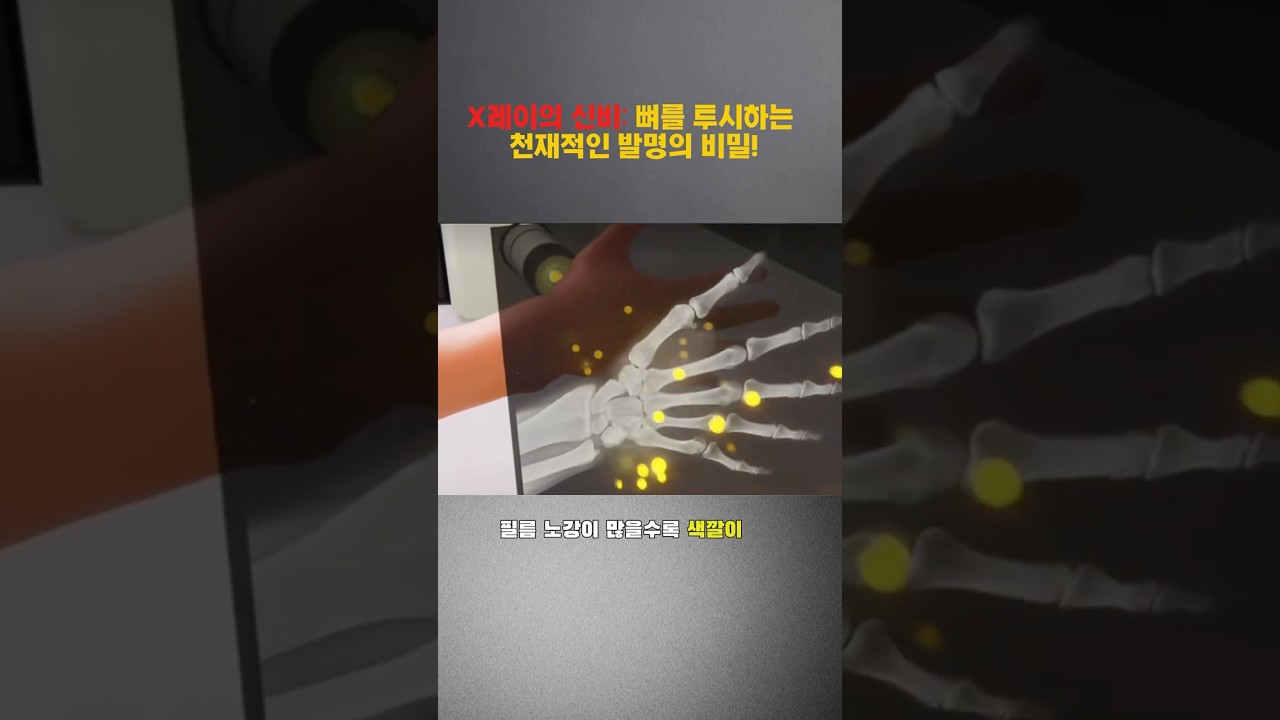 X선의 놀라운 힘! 우리 몸을 투시하다