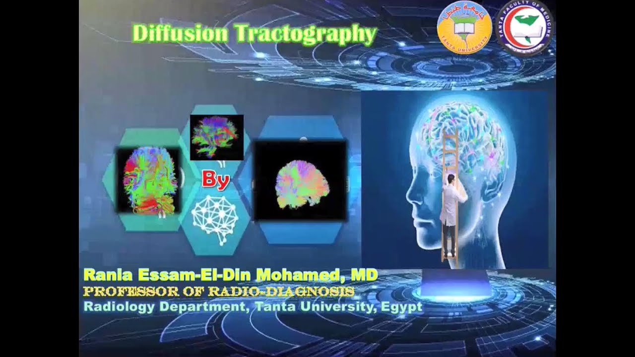 05. Brain DTI & Tractography (2) ... Prof. Dr. Rania Essameldein Mohamed
