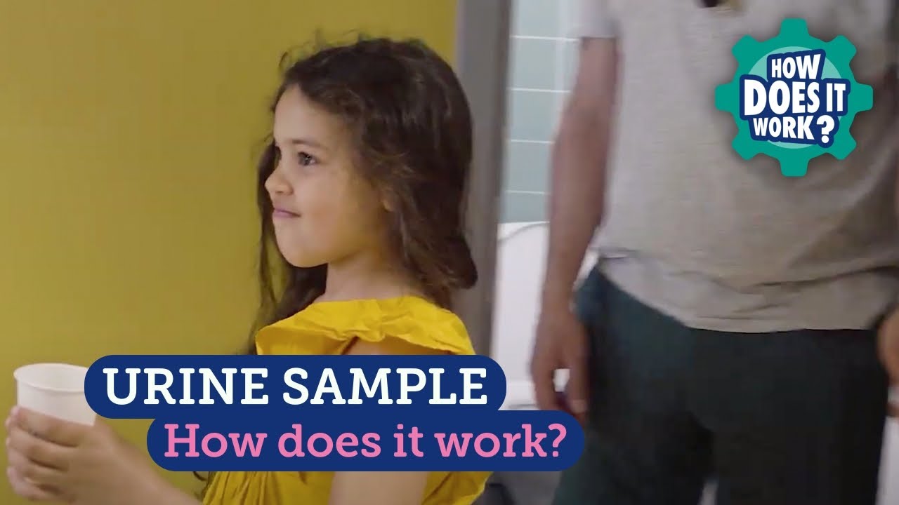 Urine Sample