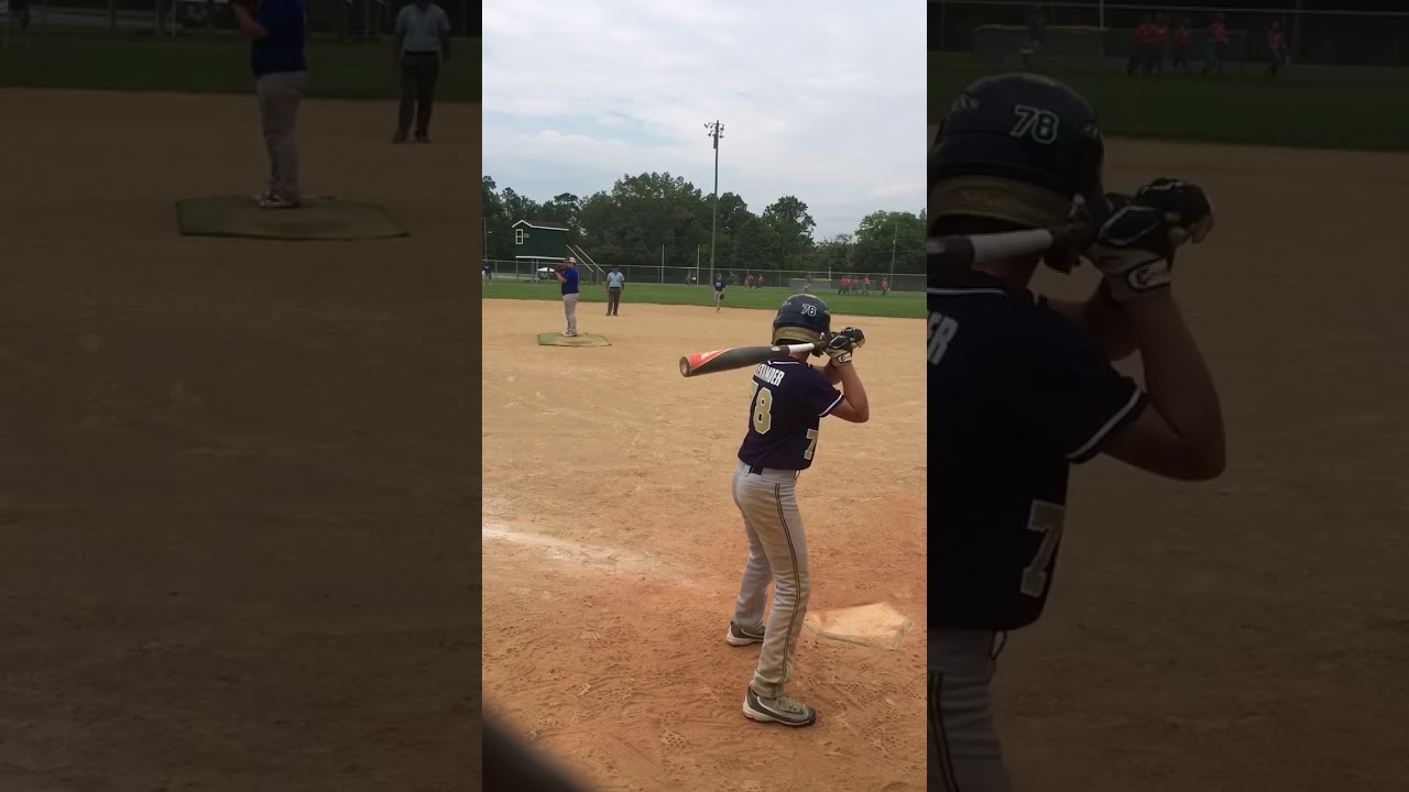 Horrible baseball injury (almost resulted in broken leg)