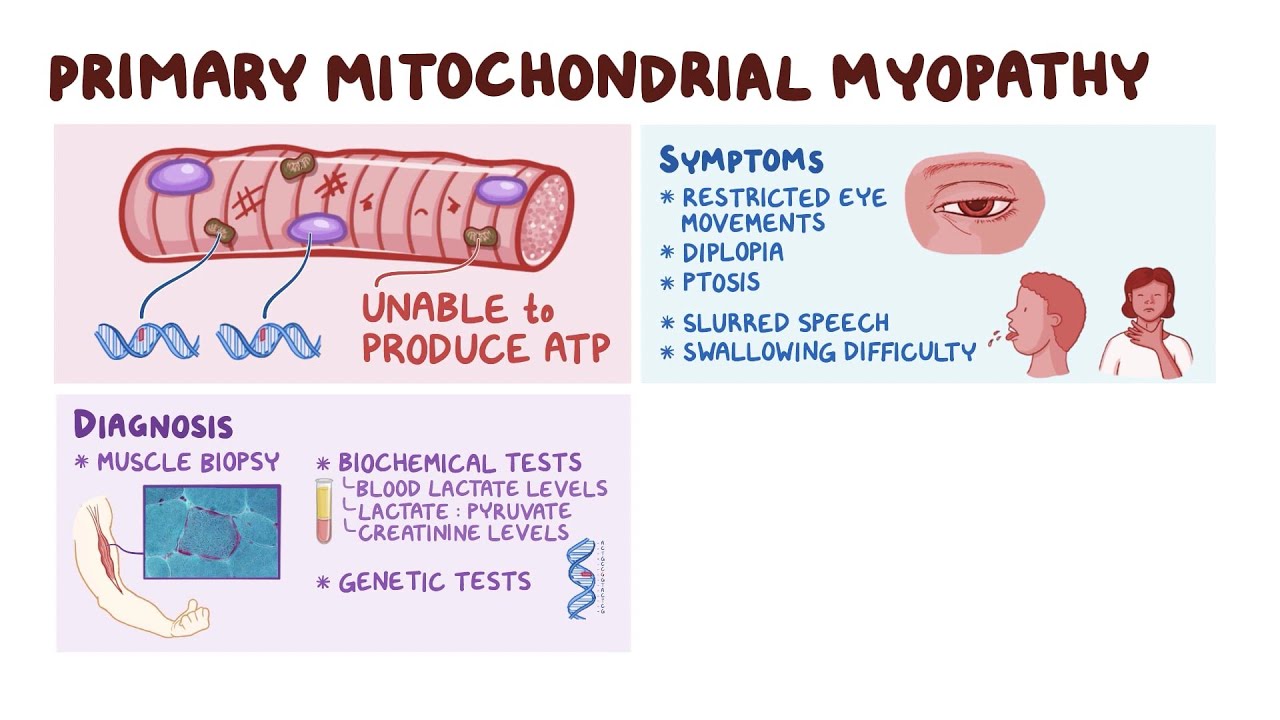 Primary Mitochondrial Myopathy: Symptoms, Causes & Treatment