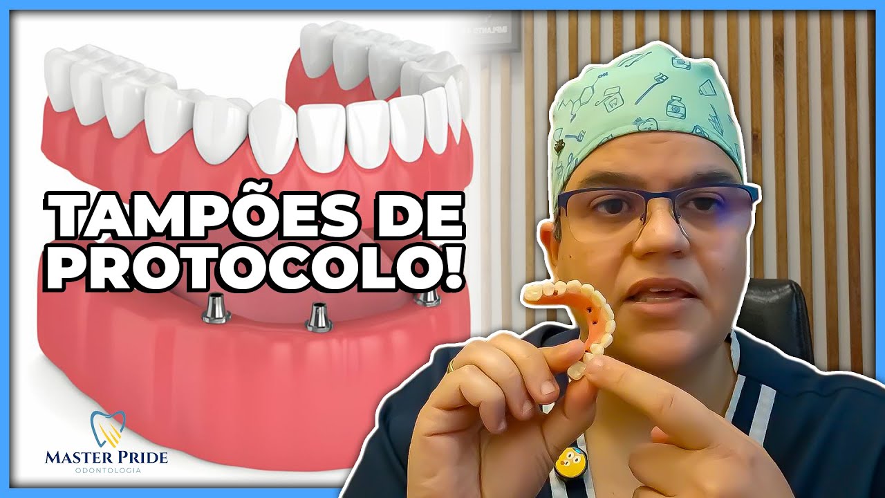 Tampão de implante: O que usar para vedar os acessos? | Master Pride Odontologia | Dra Bianca Rosa
