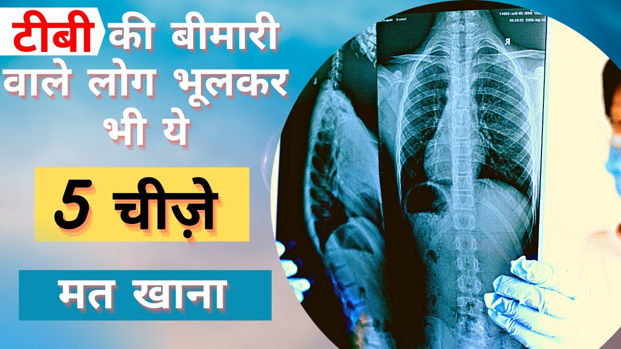 टीबी में क्या नहीं खाना चाहिए | tb me kya nahi khana chahiye | SELF DOCTOR