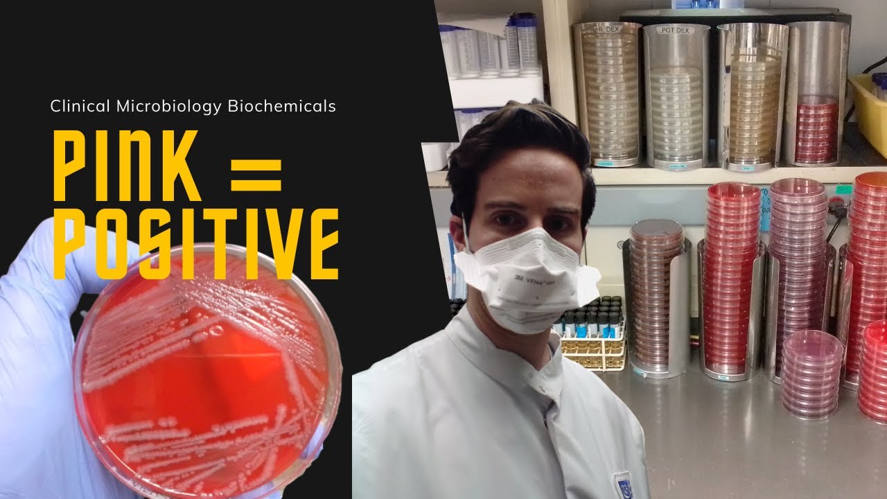 Microbiology: Indole Test for E. coli