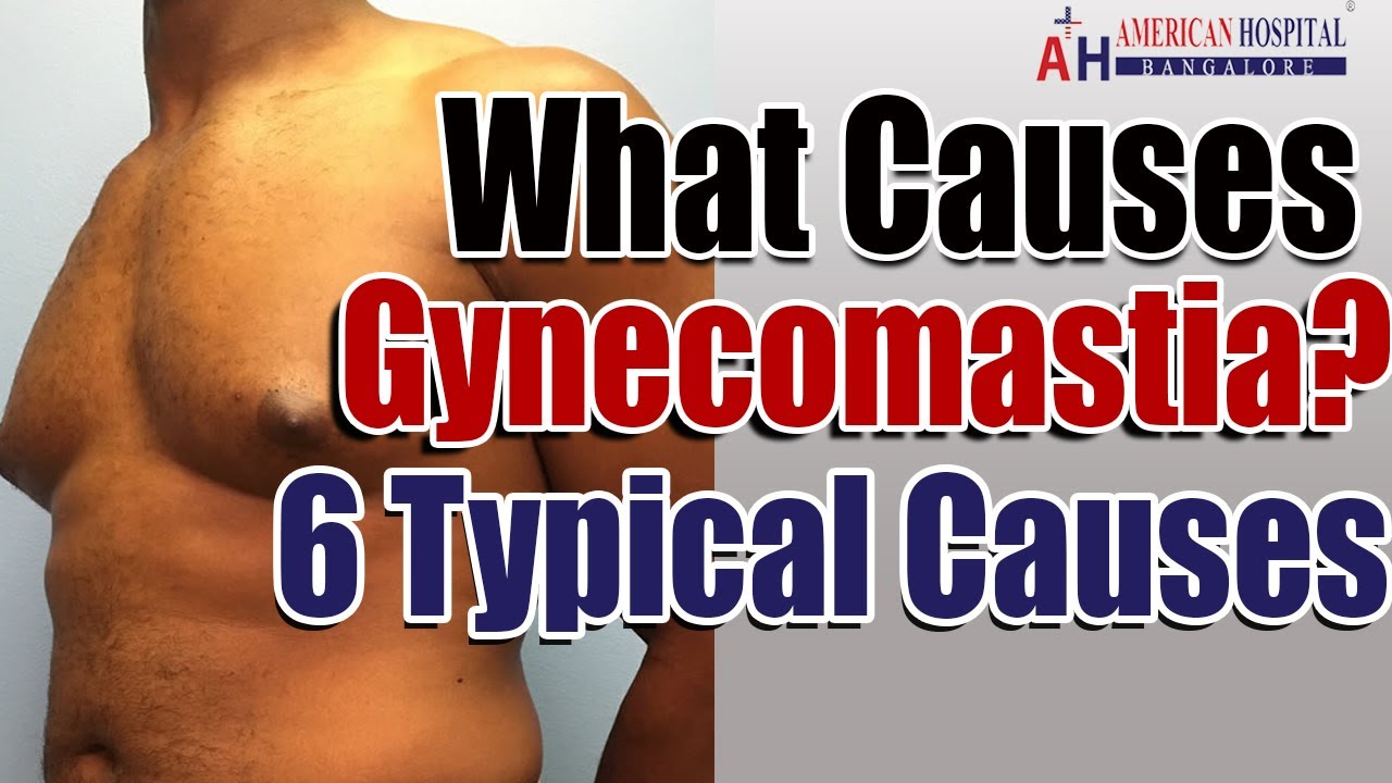 What Causes Gynecomastia? 6 Gynecomastia Causes!