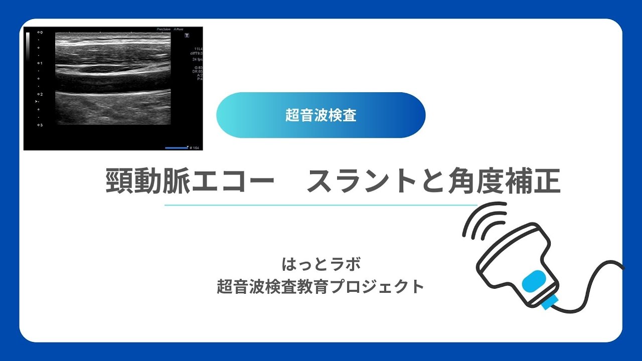 【＃超音波検査】頸動脈エコー時のスラントや角度補正について／はっとラボ