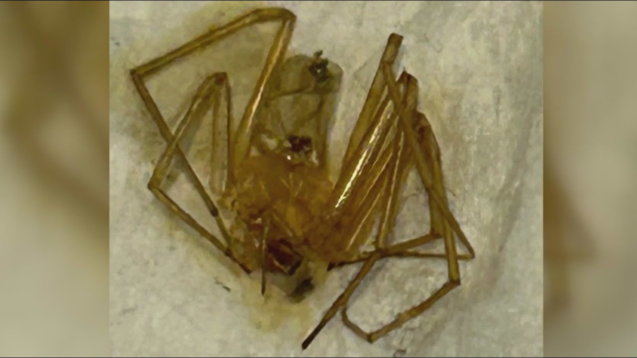 Woman sues apartment complex after spider bites lead to toe amputations