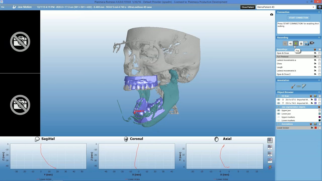 Planmeca Planmeca  4D&trade; Jaw Motion &ndash; Tutorial on Demo Case in Planmeca Romexis&reg; 4.4