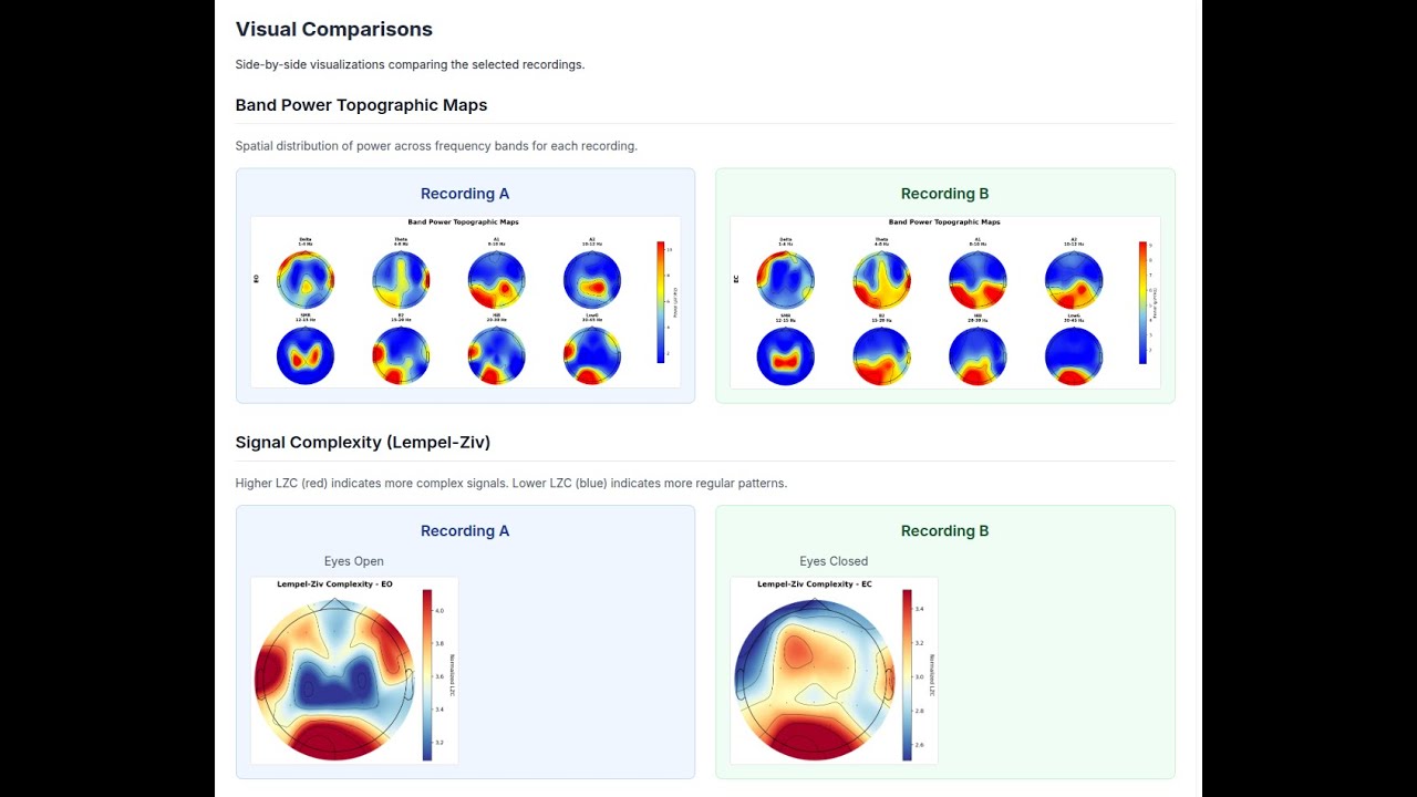 Squiggly - the opensource web-based EEG visualizer and analyzer