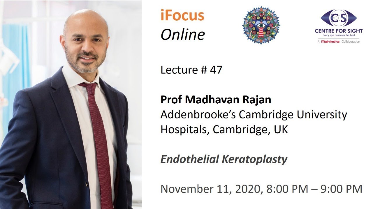 iFocus Online, Session 47, Endothelial Keratoplasty by Prof Madhavan Rajan