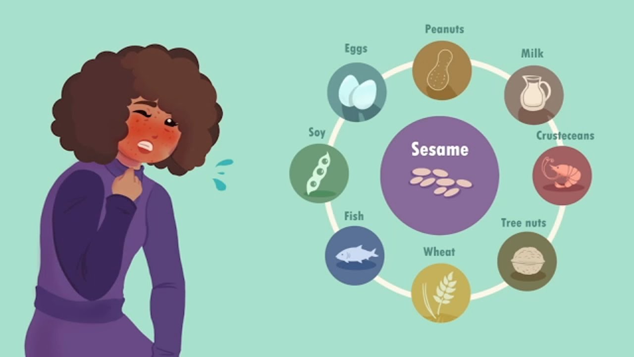 New law causing unintended consequences for those with major food allergies