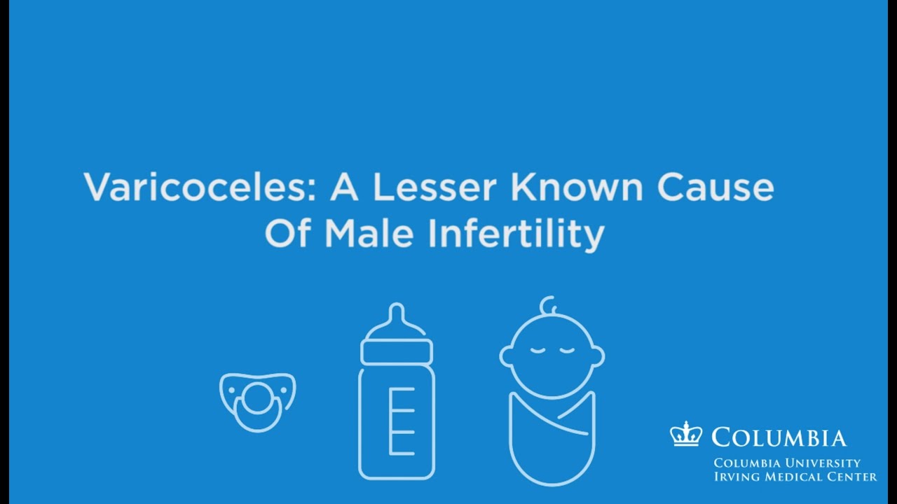 Varicoceles: A Common But Lesser Known Cause of Male Infertility