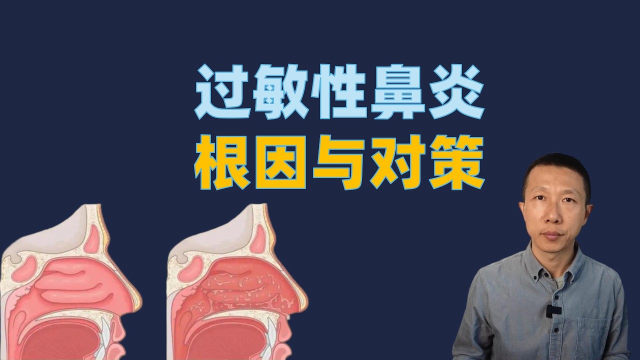 过敏性鼻炎怎么办