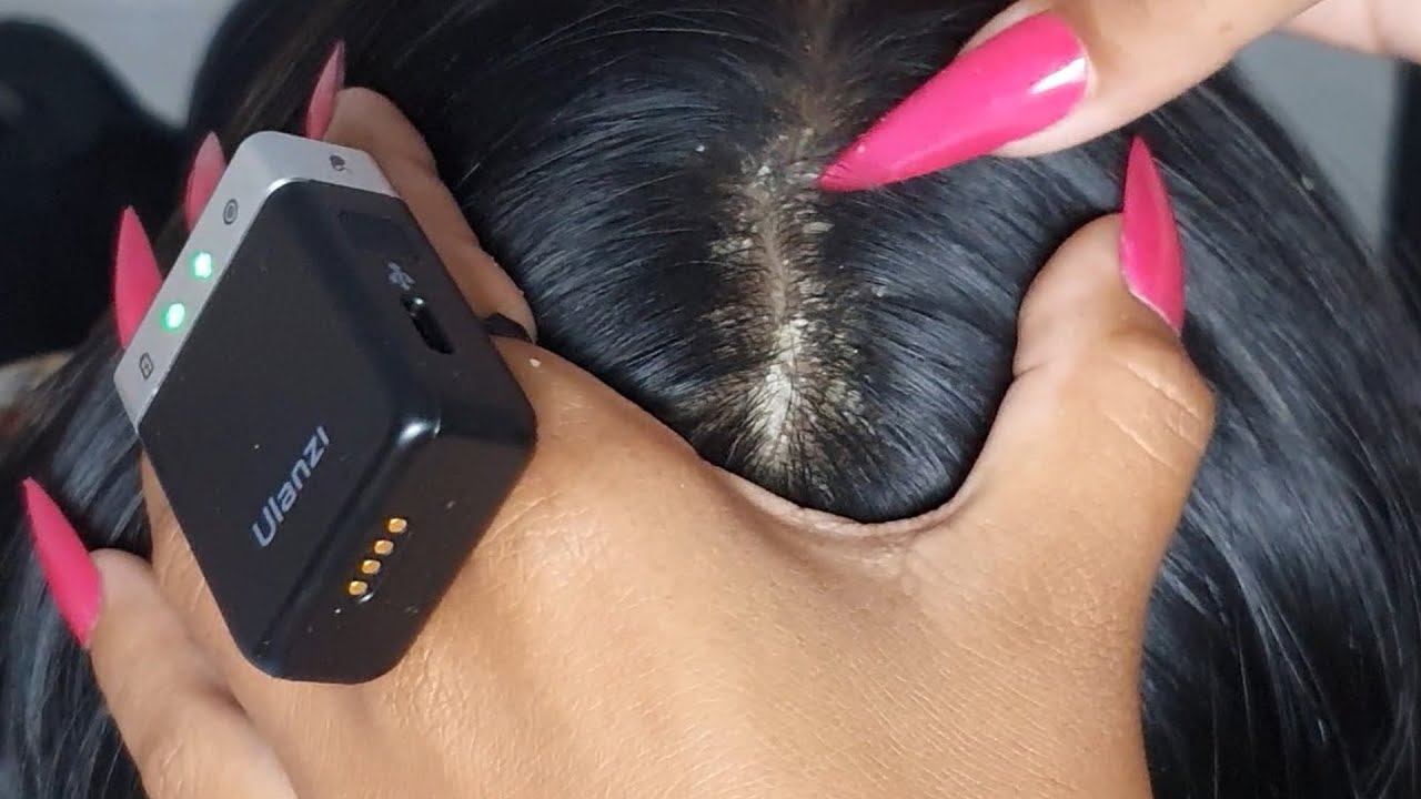 Dandruff Scratching Sounds ASMR 🧼 | Long Hair + Scalp Check Session #020