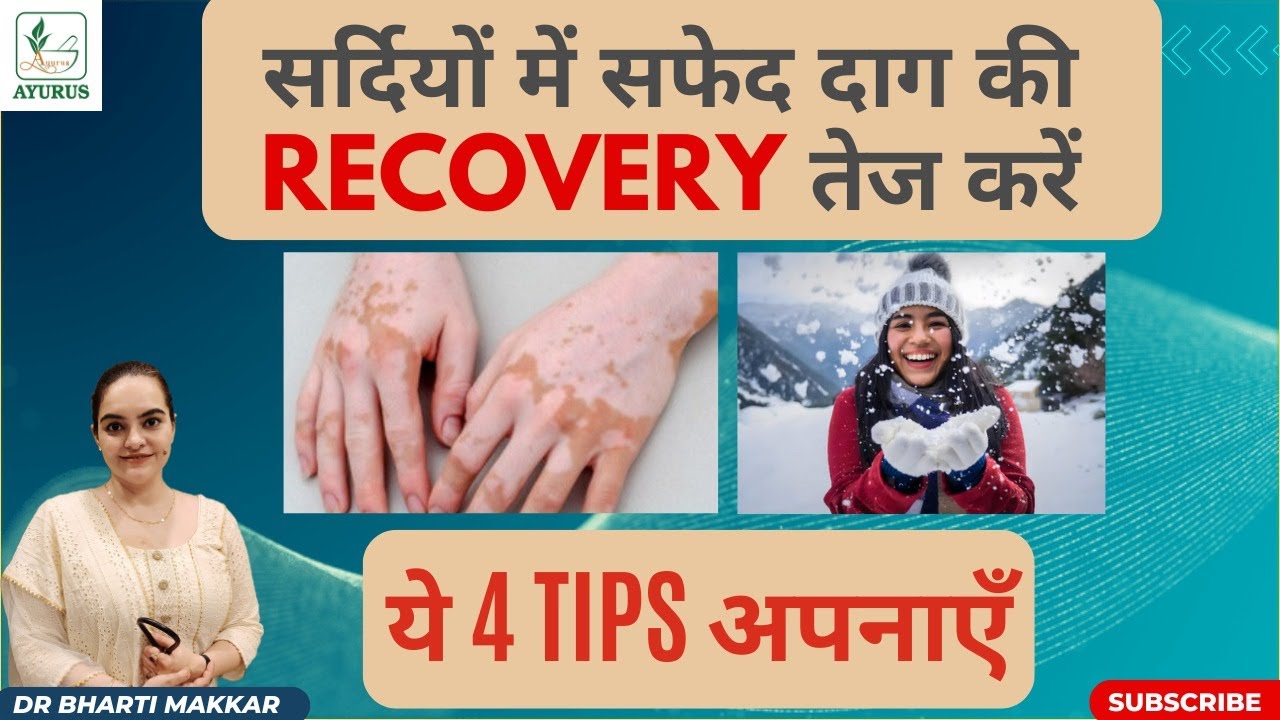 4 Simple tips for fastest recovery in Vitiligo in Winters | By Dr. Bharti Makkar #ayurveda