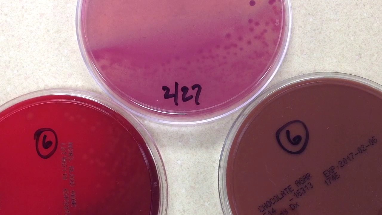 Plate Reading - CSF II