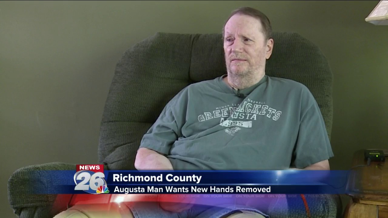 Exclusive: Man Wants Double Hand Transplant Removed